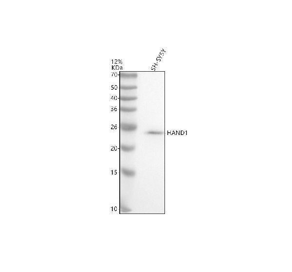 Anti-HAND1 Antibody Picoband®