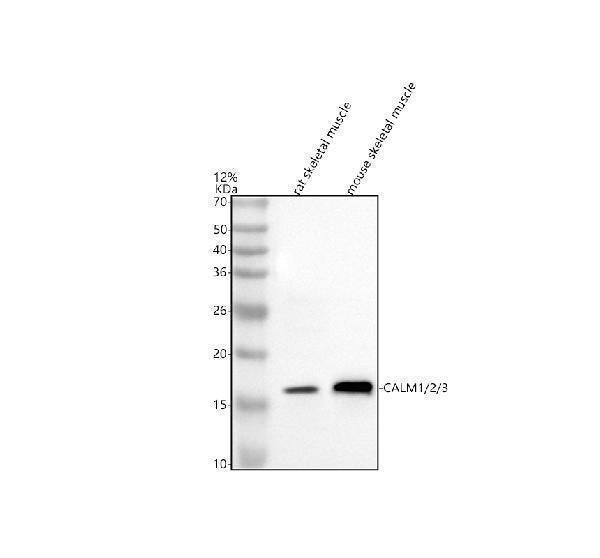 Anti-Calmodulin/CALM 1/2/3 Antibody Picoband®
