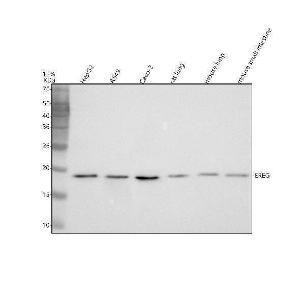 Anti-EREG Antibody Picoband®