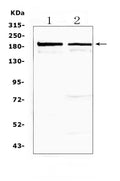 Anti-Neurocan/NCAN Antibody Picoband®