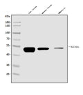 Anti-SLC10A1/NTCP1 Antibody Picoband®
