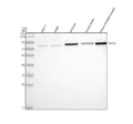 Anti-PADI2 Antibody Picoband®