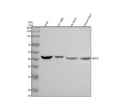 Anti-Beta Sarcoglycan/SGCB Antibody Picoband®
