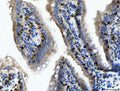 Anti-CD103/Itgae Antibody