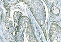Anti-CD101 Antibody