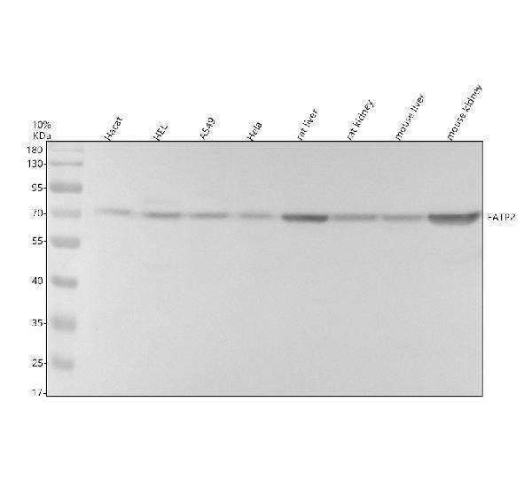 Anti-FATP2/SLC27A2 Antibody Picoband®