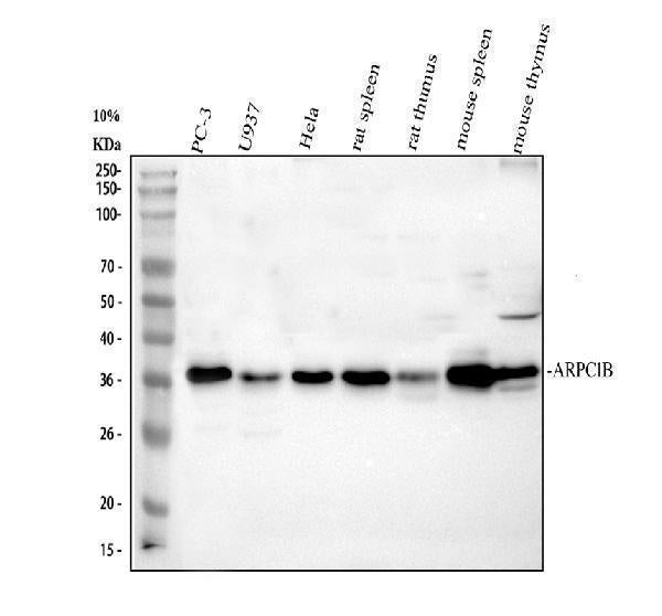 Anti-ARP2/3 subunit 1B/ARPC1B Antibody Picoband®