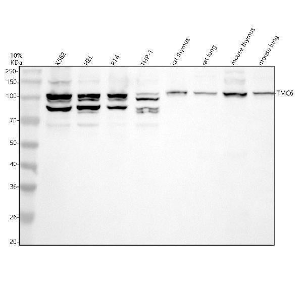 Anti-TMC6 Antibody Picoband®