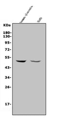 Anti-MMP28 Antibody Picoband®