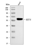 Anti-Cytokeratin 4/KRT4 Antibody Picoband®