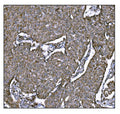 Anti-LRP1B Antibody