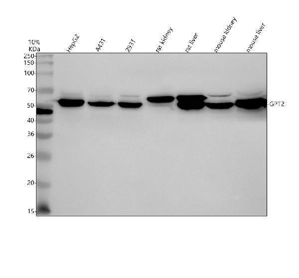 Anti-GPT2 Antibody Picoband®