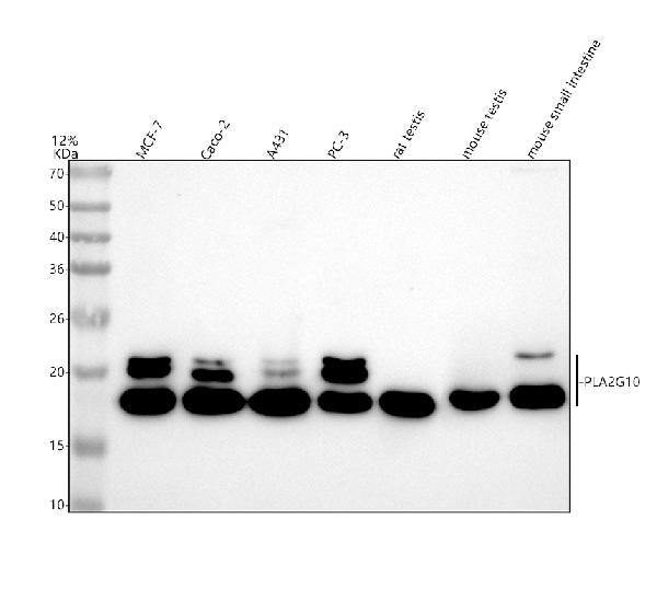 Anti-PLA2G10 Antibody Picoband®