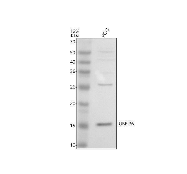 Anti-UBE2W Antibody Picoband®