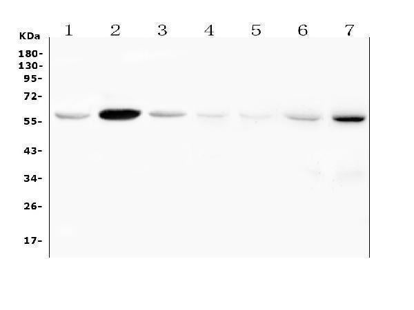Anti-Fascin 2/FSCN2 Antibody Picoband®