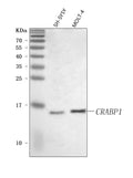 Anti-CRABP1 Antibody Picoband®