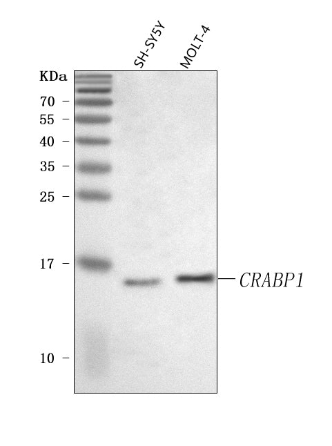 Anti-CRABP1 Antibody Picoband®