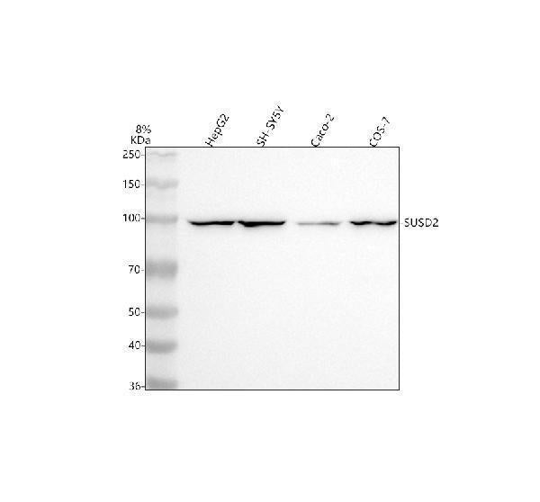 Anti-SUSD2 Antibody Picoband®