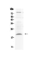 Anti-Relaxin 1/RLN1 Antibody Picoband®