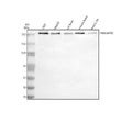 Anti-GARNL1/RALGAPA1 Antibody Picoband®