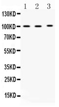Anti-ADAM2 Antibody Picoband®