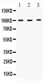 Anti-ADAM2 Antibody Picoband®