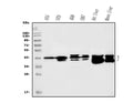 Anti-SBCAD/ACADSB Antibody Picoband®