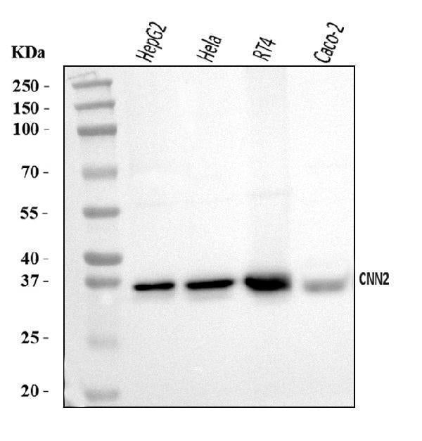 Anti-Calponin 2/CNN2 Antibody Picoband®