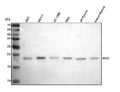 Anti-C16orf75/RMI2 Antibody Picoband®