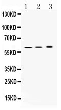 Anti-Hydrogen Potassium ATPase Beta/ATP4B Antibody Picoband®