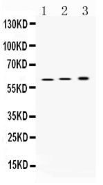 Anti-Hydrogen Potassium ATPase Beta/ATP4B Antibody Picoband®