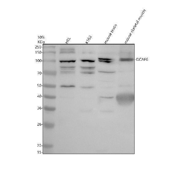 Anti-DCAF6 Antibody Picoband®