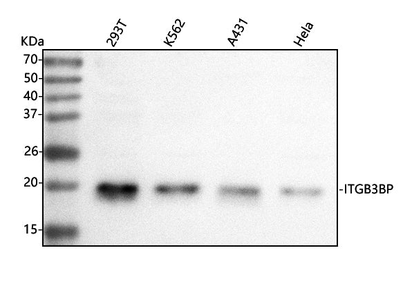 Anti-Centromere protein R/ITGB3BP Antibody Picoband®