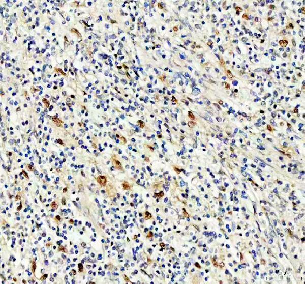 Anti-NKX2-3 Antibody