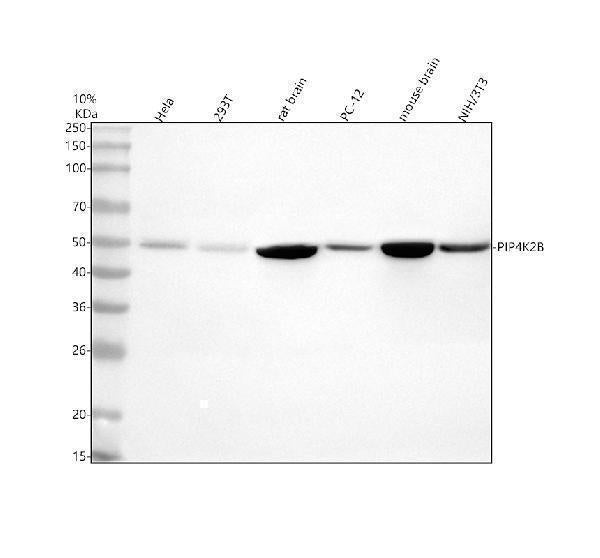 Anti-PIP4K2B Antibody Picoband®