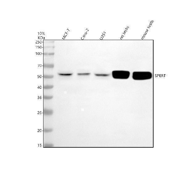 Anti-CBY2 Antibody Picoband®