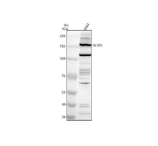 Anti-SETD5 Antibody Picoband®