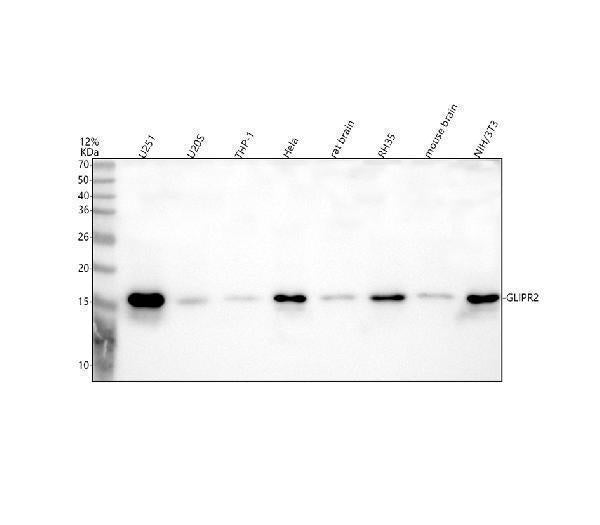 Anti-GLIPR2 Antibody Picoband®