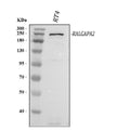 Anti-C20orf74/RALGAPA2 Antibody Picoband®