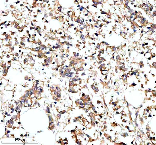 Anti-PARP16 Antibody
