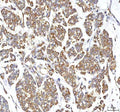 Anti-GOLGA7 Antibody