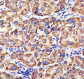 Anti-TIMM9 Antibody