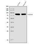 Anti-cPLA2 beta/PLA2G4B Antibody Picoband®