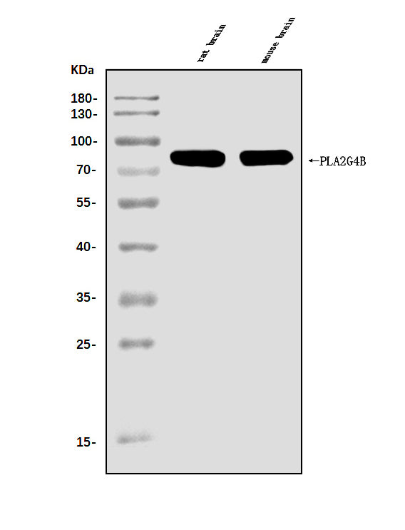 Anti-cPLA2 beta/PLA2G4B Antibody Picoband®