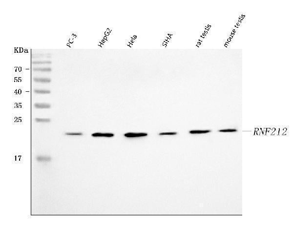 Anti-RNF212 Antibody Picoband®