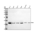 Anti-PFDN2 Antibody Picoband®