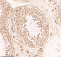 Anti-DAND5 Antibody