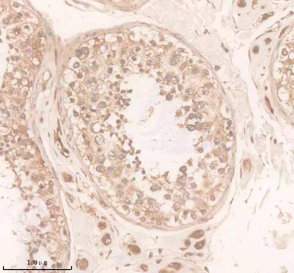 Anti-DAND5 Antibody