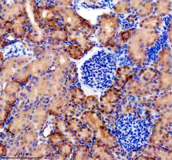 Anti-OSTbeta/SLC51B Antibody