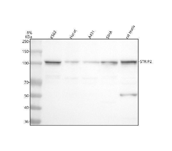 Anti-FAM40B/STRIP2 Antibody Picoband®